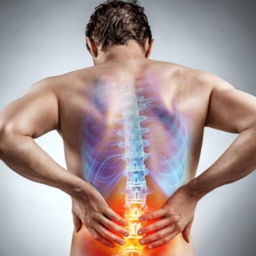 Sciatica-main-image-e1565352105794